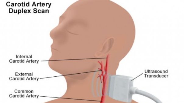 Na neurologiji za tri dana pregledano 220 pacijenata