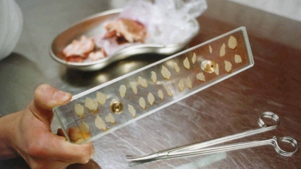 Nema slučajeva trihinele