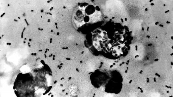 Америчка војска признала да је непажљиво руковала узорцима куге