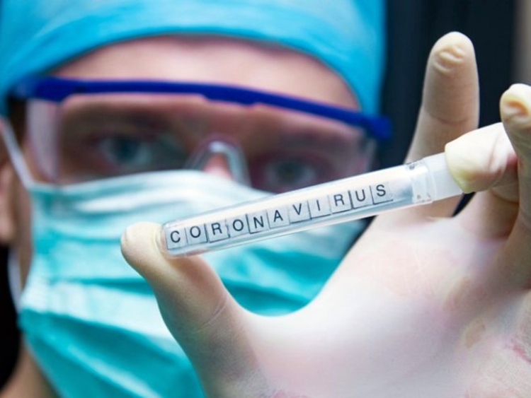 Српској 86 нових случајева, укупно 3.607; Опорављено 1.797 особа