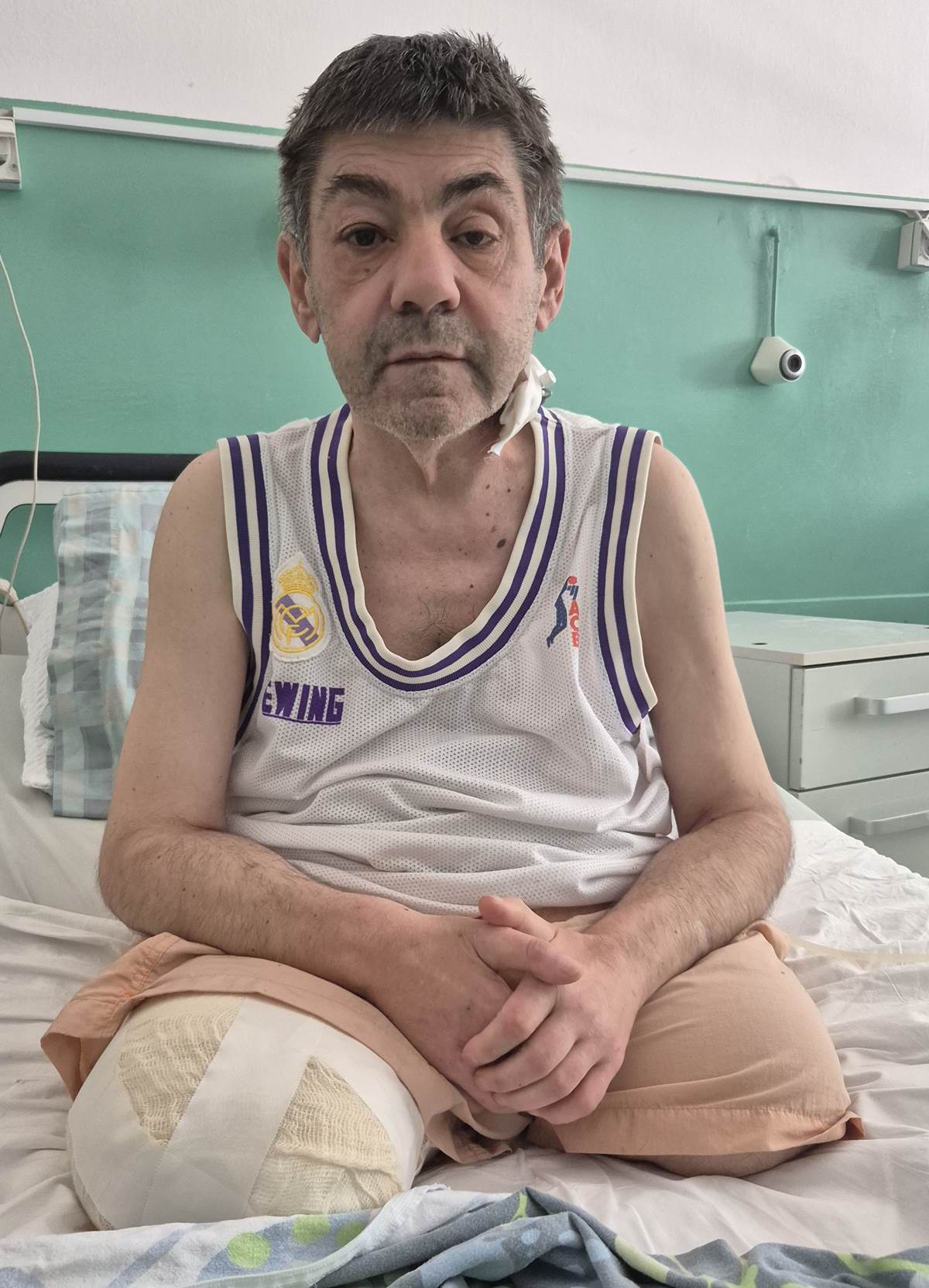 Кад осмјех није ампутиран